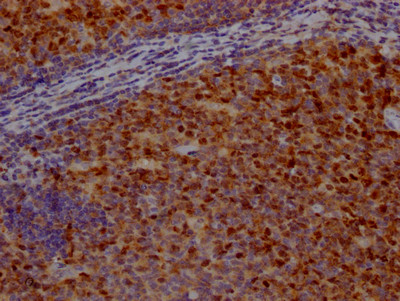 Survivin Antibody in Immunohistochemistry (Paraffin) (IHC (P))