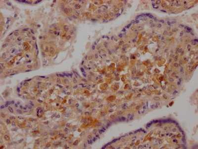 RIG-I Antibody in Immunohistochemistry (Paraffin) (IHC (P))