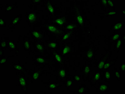 ILF3 Antibody in Immunocytochemistry (ICC/IF)