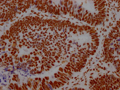 ILF3 Antibody in Immunohistochemistry (Paraffin) (IHC (P))