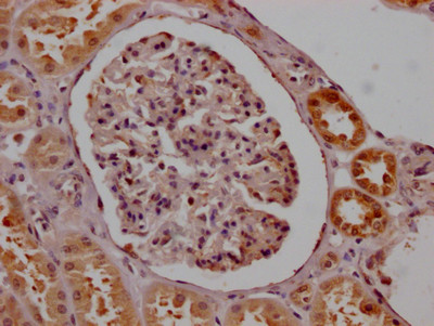 SMN1 Antibody in Immunohistochemistry (Paraffin) (IHC (P))