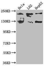 Mgea5 Antibody in Western Blot (WB)