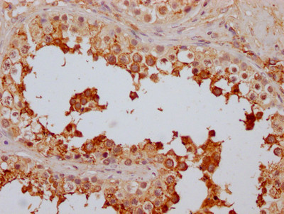 FAAH Antibody in Immunohistochemistry (Paraffin) (IHC (P))