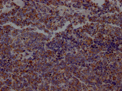 Aconitase 2 Antibody in Immunohistochemistry (Paraffin) (IHC (P))