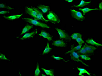 GSK3B Antibody in Immunocytochemistry (ICC/IF)