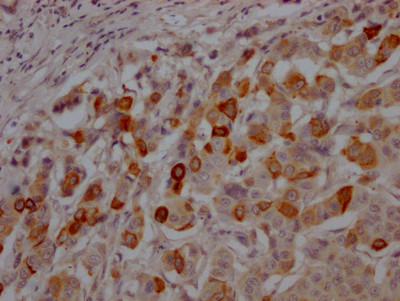 GSK3B Antibody in Immunohistochemistry (Paraffin) (IHC (P))