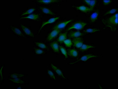 Cyclin E Antibody in Immunocytochemistry (ICC/IF)