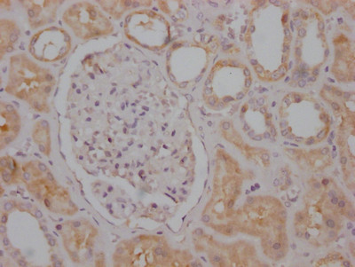 Raptor Antibody in Immunohistochemistry (Paraffin) (IHC (P))