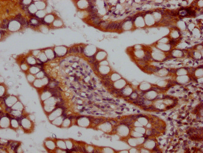 Raptor Antibody in Immunohistochemistry (Paraffin) (IHC (P))