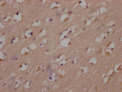 Fyn Antibody in Immunohistochemistry (Paraffin) (IHC (P))