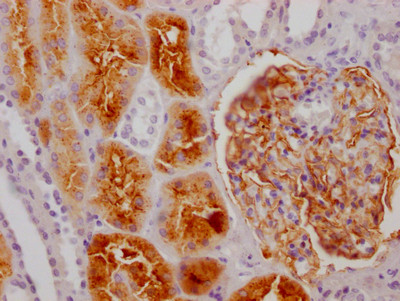 CD249 Antibody in Immunohistochemistry (Paraffin) (IHC (P))