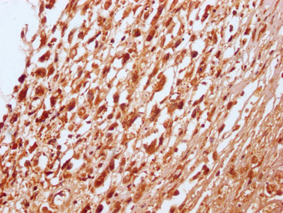 RNF20 Antibody in Immunohistochemistry (Paraffin) (IHC (P))