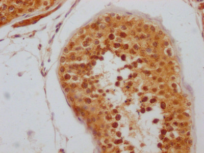 RNF20 Antibody in Immunohistochemistry (Paraffin) (IHC (P))