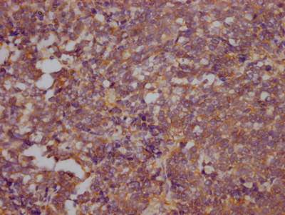 RhoA Antibody in Immunohistochemistry (Paraffin) (IHC (P))