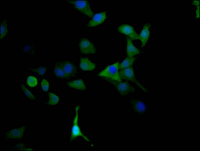 MAOA Antibody in Immunocytochemistry (ICC/IF)