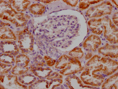 MAOA Antibody in Immunohistochemistry (Paraffin) (IHC (P))