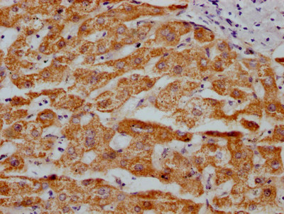 MAOA Antibody in Immunohistochemistry (Paraffin) (IHC (P))