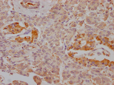 FBP1 Antibody in Immunohistochemistry (Paraffin) (IHC (P))