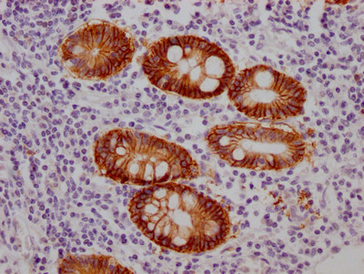 A33 Antibody in Immunohistochemistry (Paraffin) (IHC (P))