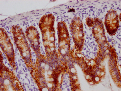 A33 Antibody in Immunohistochemistry (Paraffin) (IHC (P))