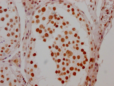 HSF1 Antibody in Immunohistochemistry (Paraffin) (IHC (P))