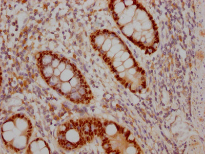 SOX9 Antibody in Immunohistochemistry (Paraffin) (IHC (P))