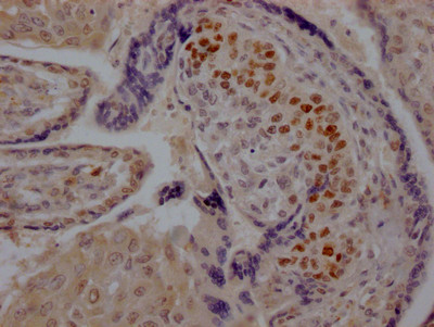 SKP2 Antibody in Immunohistochemistry (Paraffin) (IHC (P))