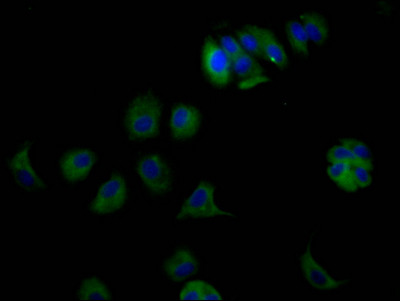 ErbB3 Antibody in Immunocytochemistry (ICC/IF)