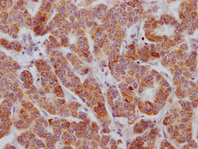 ACVR2B Antibody in Immunohistochemistry (Paraffin) (IHC (P))