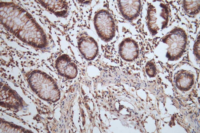 HSP90 beta Antibody in Immunohistochemistry (Paraffin) (IHC (P))