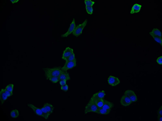 Aconitase 1 Antibody in Immunocytochemistry (ICC/IF)