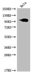 Aconitase 1 Antibody in Western Blot (WB)