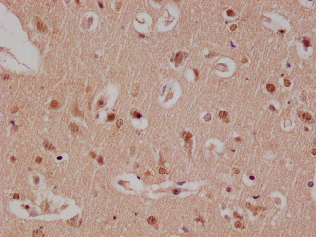 E2F4 Antibody in Immunohistochemistry (Paraffin) (IHC (P))