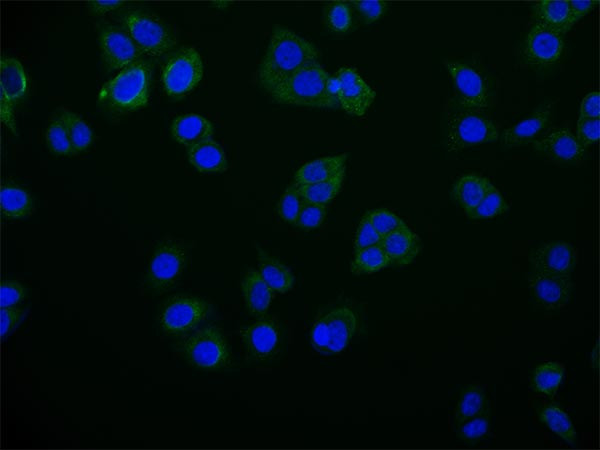 RAB25 Antibody in Immunocytochemistry (ICC/IF)