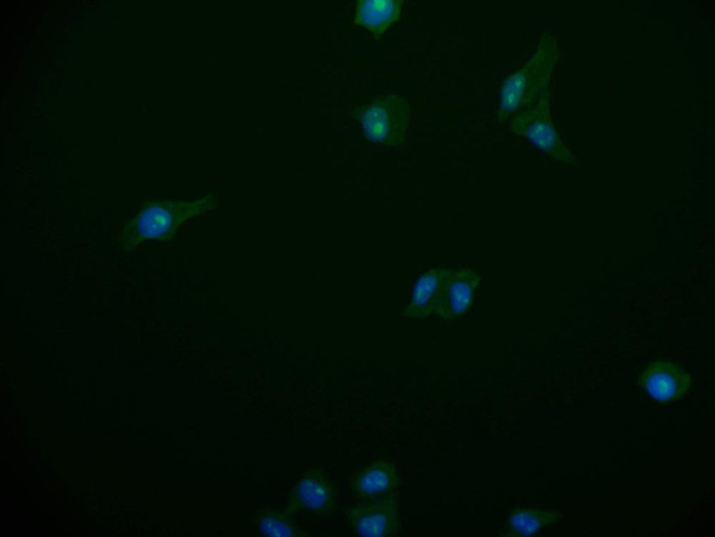 PSME1 Antibody in Immunocytochemistry (ICC/IF)