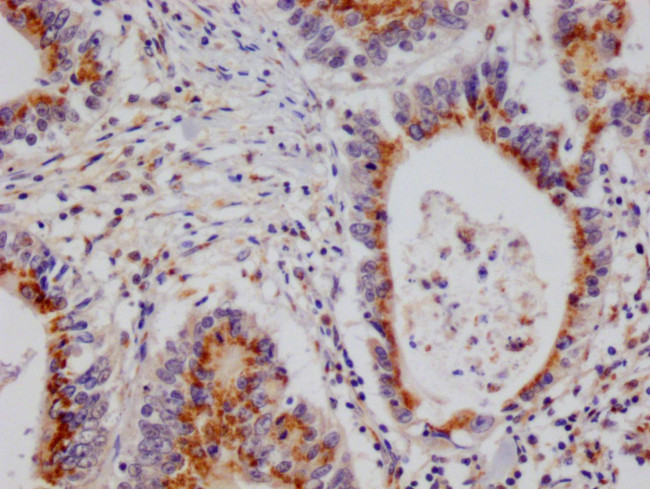 PSME1 Antibody in Immunohistochemistry (Paraffin) (IHC (P))