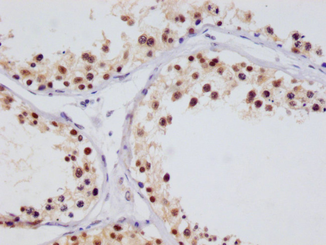 HIF1AN Antibody in Immunohistochemistry (Paraffin) (IHC (P))