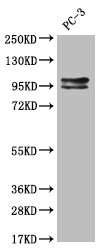 KAP3 Antibody in Western Blot (WB)