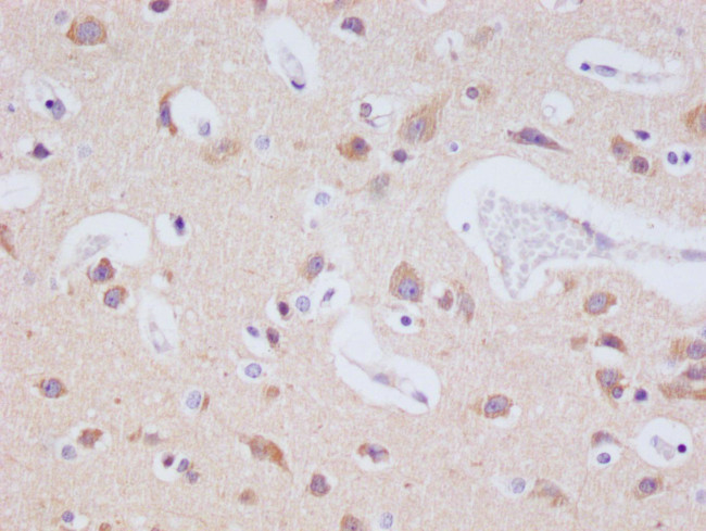 JNK3 Antibody in Immunohistochemistry (Paraffin) (IHC (P))