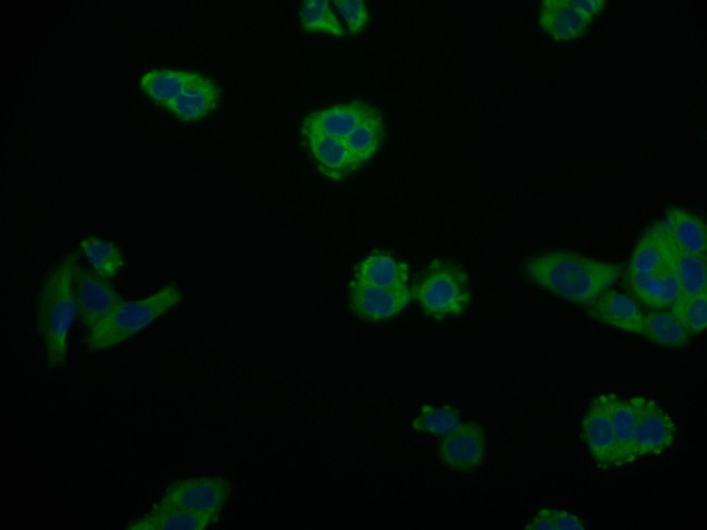 Arginase 2 Antibody in Immunocytochemistry (ICC/IF)