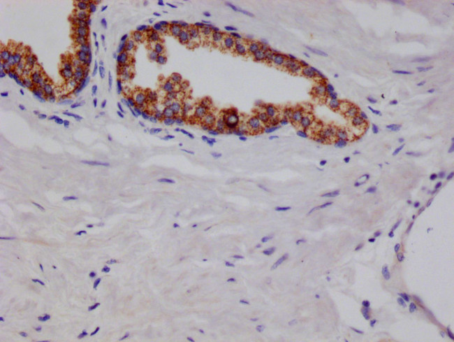 Arginase 2 Antibody in Immunohistochemistry (Paraffin) (IHC (P))