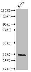 NUDT5 Antibody in Western Blot (WB)