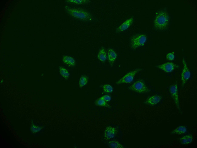 ACAA2 Antibody in Immunocytochemistry (ICC/IF)