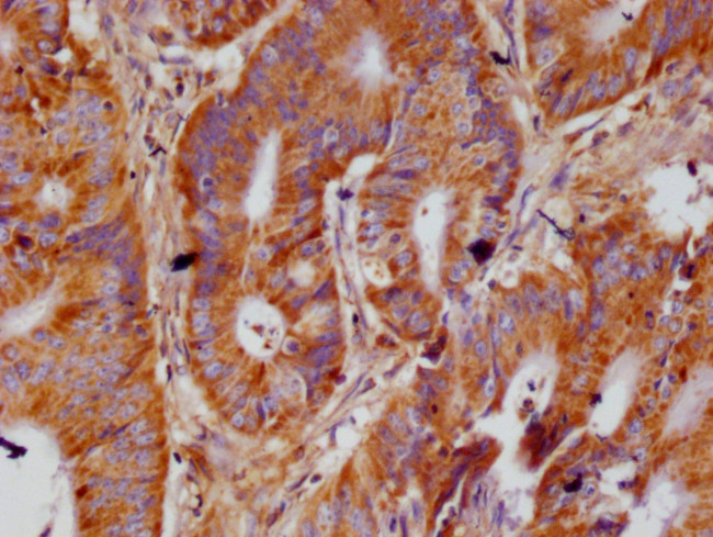 ACAA2 Antibody in Immunohistochemistry (Paraffin) (IHC (P))