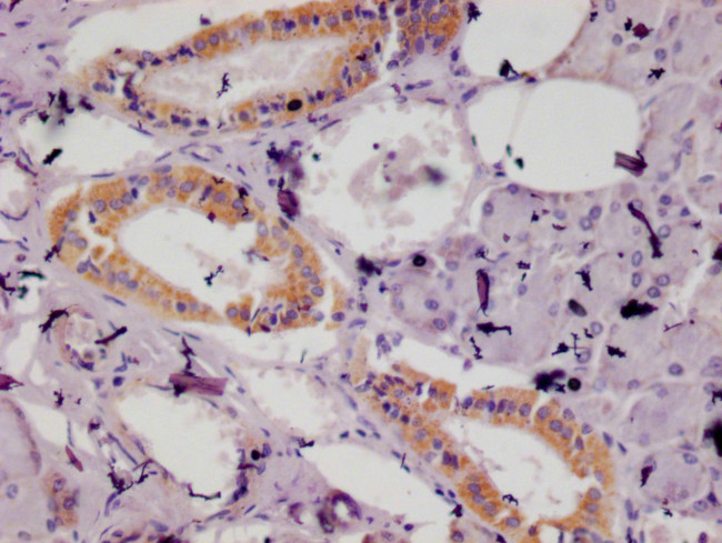 ISG15 Antibody in Immunohistochemistry (Paraffin) (IHC (P))