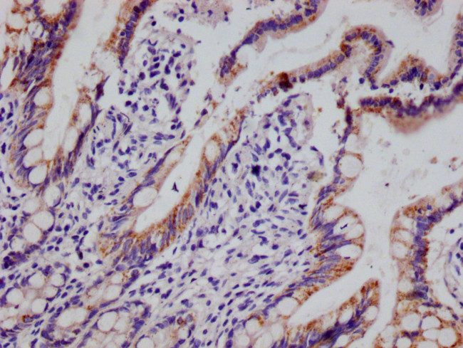 HMGCS2 Antibody in Immunohistochemistry (Paraffin) (IHC (P))