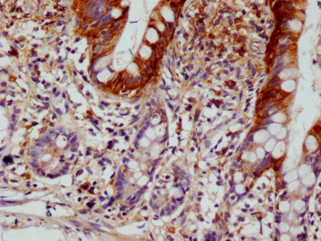 SCIN Antibody in Immunohistochemistry (Paraffin) (IHC (P))