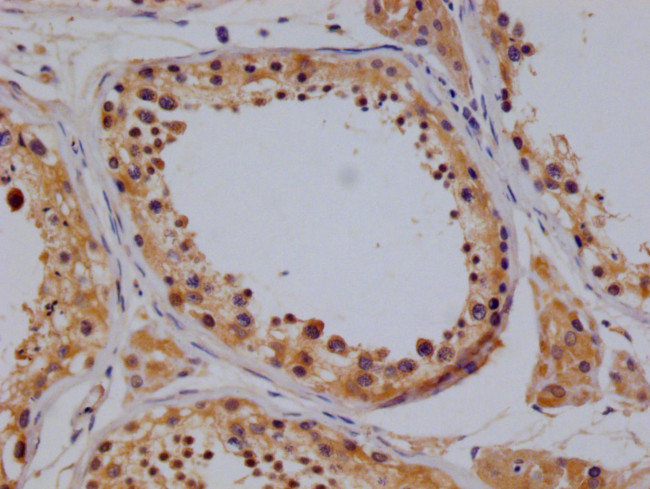 TBK1 Antibody in Immunohistochemistry (Paraffin) (IHC (P))