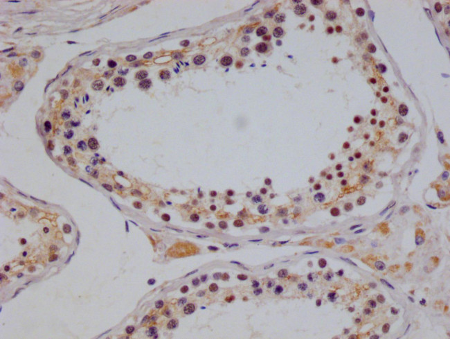 NTHL1 Antibody in Immunohistochemistry (Paraffin) (IHC (P))