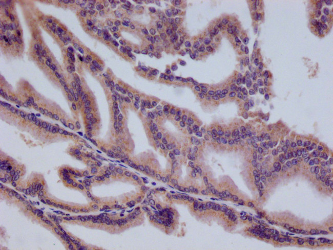 HMGCL Antibody in Immunohistochemistry (Paraffin) (IHC (P))